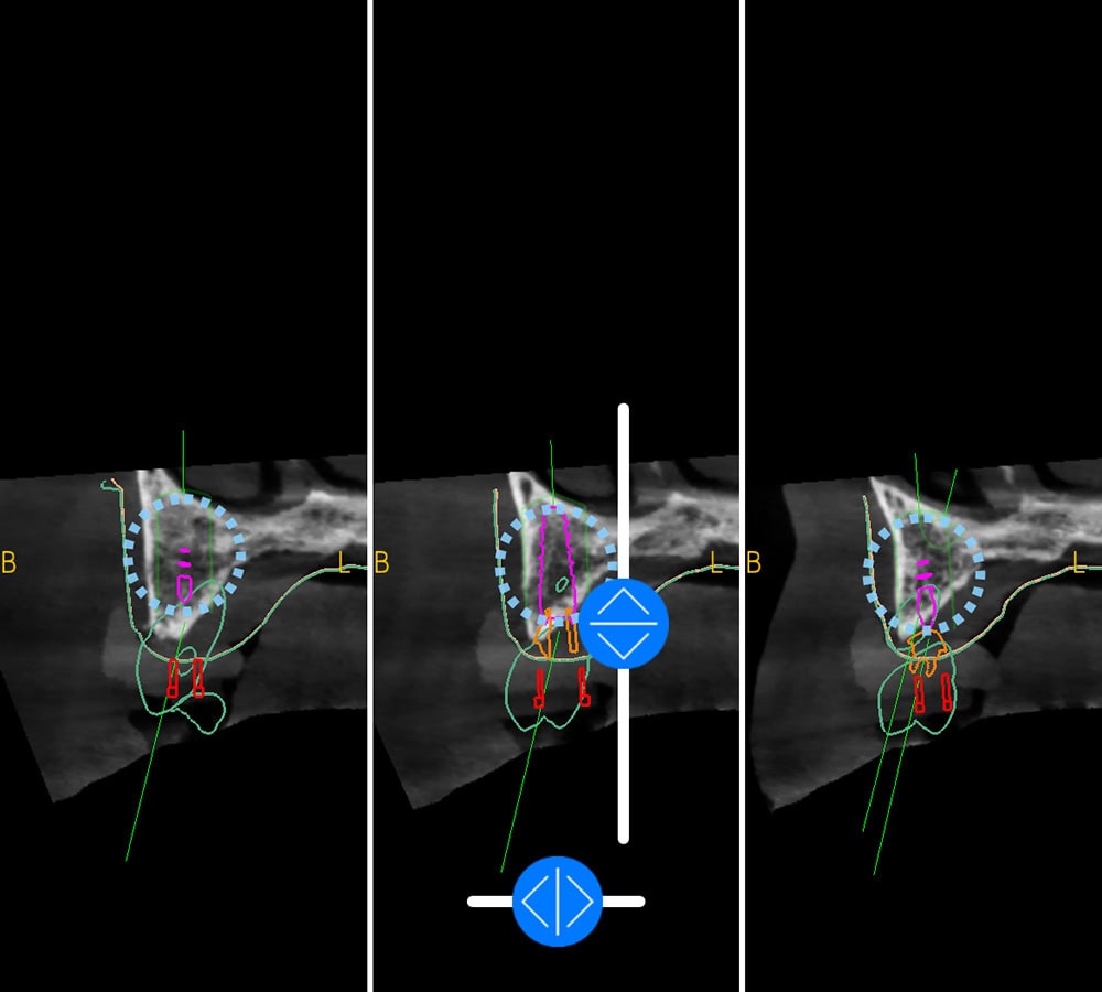 3d dental radiograph harrogate dentist